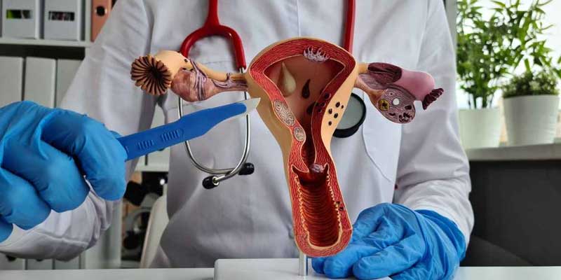 Laparoscopic Surgery