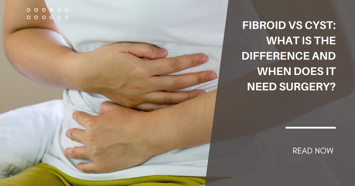 Fibroid vs Cyst