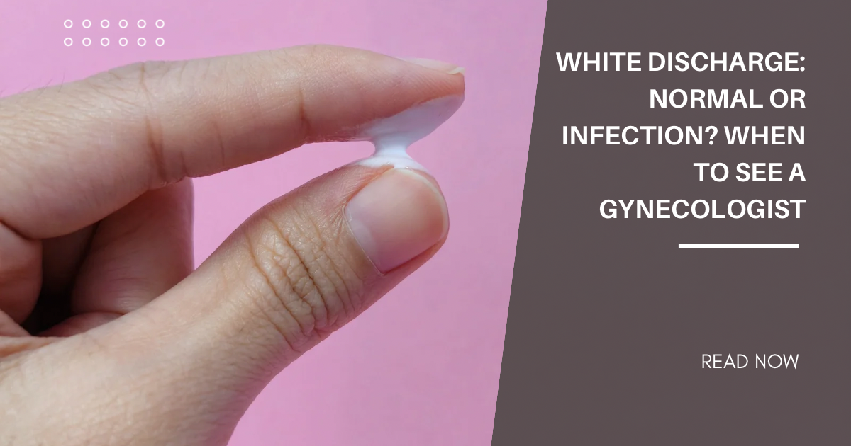 white discharge image
